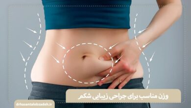 تصویر وزن مناسب برای جراحی زیبایی ابدومینوپلاستی و لیپوساکشن