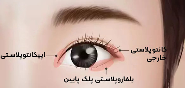 عمل درشت کردن چشم