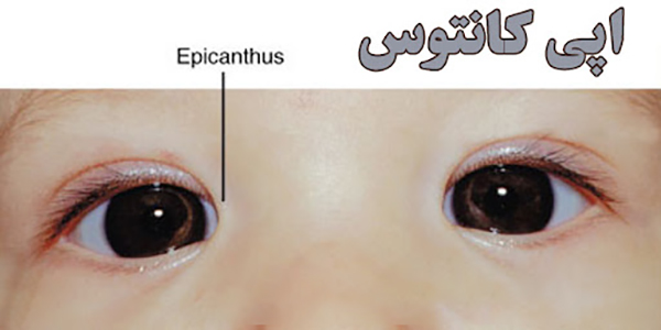 عمل درشت کردن چشم